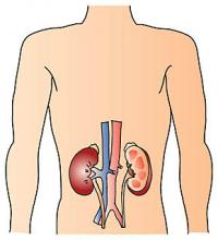 慢性腎臓病（CKD)